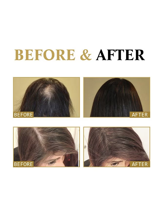 Regrowth Organic Hair Serum Roller